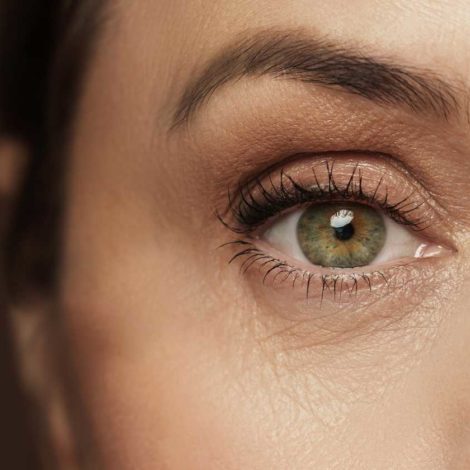 estetica arrugas ojos