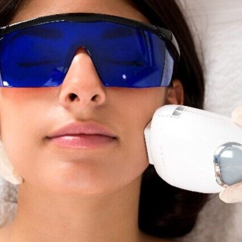 LASER DIODO REJUVENECIMIENTO FACIAL