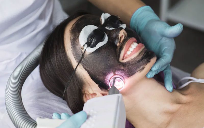 tratamientos láser acarbono láser q-switched en Tarragona